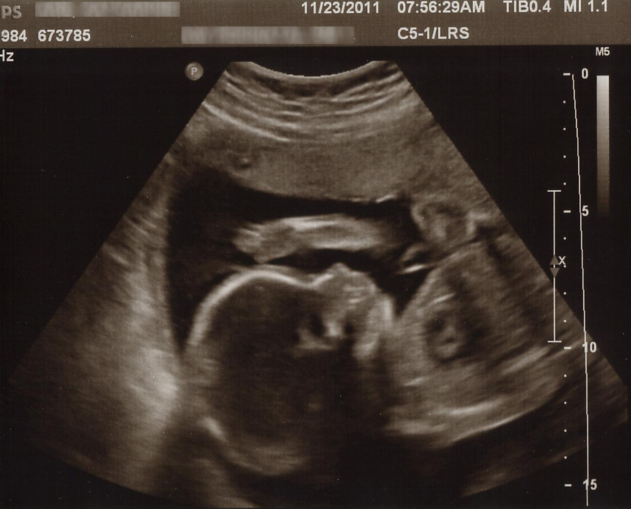 Isla 24 Week Ultrasound Mom In Leggings